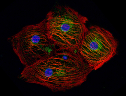 Gladstone Conklin Miyaoka Gene Editing