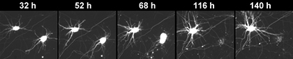 Gladstone-Finkbeiner-LRRK2